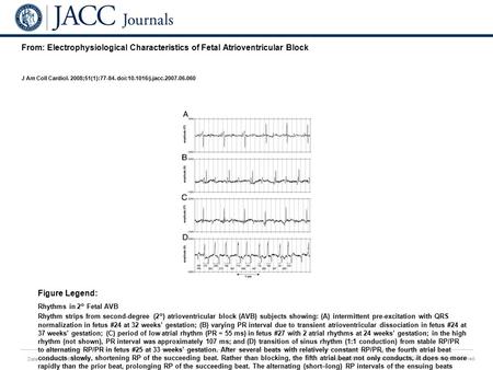 Date of download: 6/28/2016 Copyright © The American College of Cardiology. All rights reserved. From: Electrophysiological Characteristics of Fetal Atrioventricular.