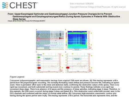 Date of download: 6/28/2016 Copyright © American College of Chest Physicians. All rights reserved. From: Upper Esophageal Sphincter and Gastroesophageal.