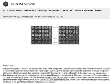 Date of download: 6/28/2016 Copyright © 2016 American Medical Association. All rights reserved. From: In Vivo Brain Concentrations of N-Acetyl Compounds,