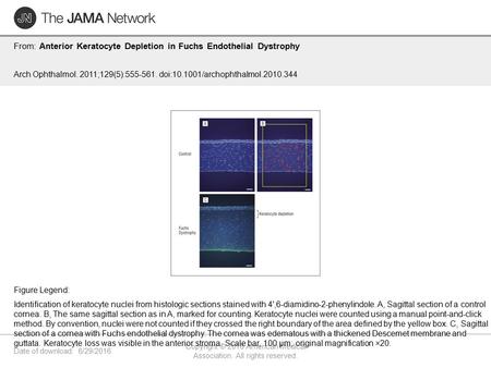 Date of download: 6/29/2016 Copyright © 2016 American Medical Association. All rights reserved. From: Anterior Keratocyte Depletion in Fuchs Endothelial.