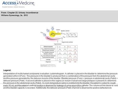 Date of download: 6/29/2016 Copyright © 2016 McGraw-Hill Education. All rights reserved. Interpretation of multichannel urodynamic evaluation: cystometrogram.