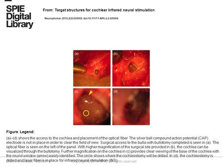 Date of download: 6/29/2016 Copyright © 2016 SPIE. All rights reserved. (a)–(d) shows the access to the cochlea and placement of the optical fiber. The.