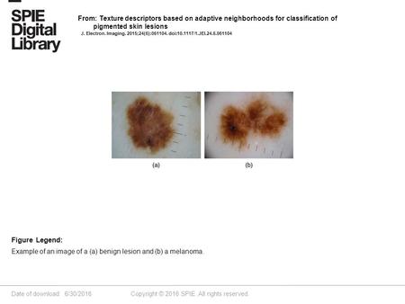 Date of download: 6/30/2016 Copyright © 2016 SPIE. All rights reserved. Example of an image of a (a) benign lesion and (b) a melanoma. Figure Legend: From: