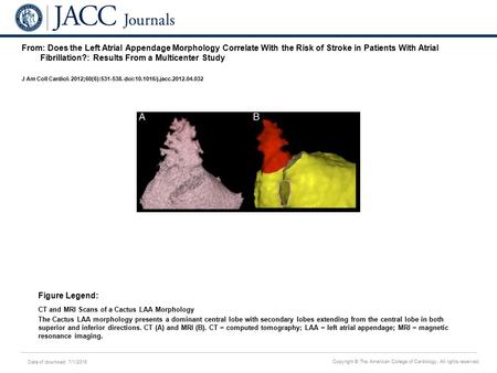 Date of download: 7/1/2016 Copyright © The American College of Cardiology. All rights reserved. From: Does the Left Atrial Appendage Morphology Correlate.