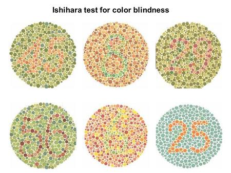 Ishihara test for color blindness