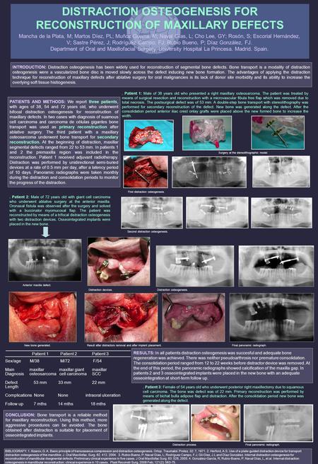 DISTRACTION OSTEOGENESIS FOR RECONSTRUCTION OF MAXILLARY DEFECTS Mancha de la Plata, M; Martos Díez, PL; Muñoz Guerra, M; Naval Gías, L; Cho Lee, GY; Rosón,