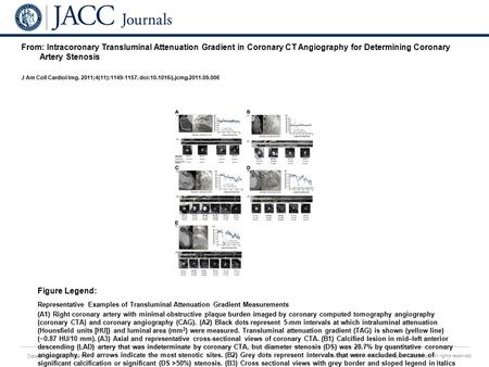 Date of download: 7/1/2016 Copyright © The American College of Cardiology. All rights reserved. From: Intracoronary Transluminal Attenuation Gradient in.