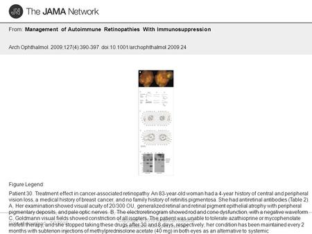 Date of download: 7/2/2016 Copyright © 2016 American Medical Association. All rights reserved. From: Management of Autoimmune Retinopathies With Immunosuppression.