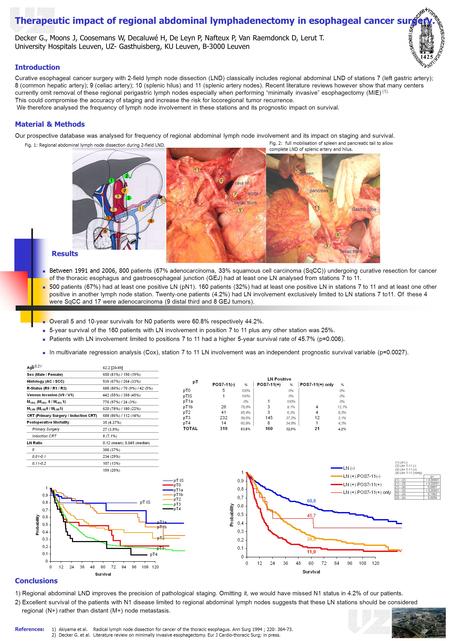 Fig. 1: Regional abdominal lymph node dissection during 2-field LND. Fig. 2: full mobilisation of spleen and pancreatic tail to allow complete LND of.