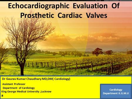 Thanks ………… Echocardiographic Evaluation Of Prosthetic Cardiac Valves Dr Gaurav Kumar Chaudhary MD,DM( Cardiology) Assistant Professor Department of Cardiology.