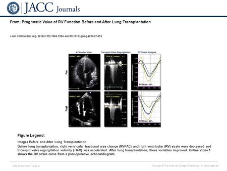 Date of download: 7/2/2016 Copyright © The American College of Cardiology. All rights reserved. From: Prognostic Value of RV Function Before and After.