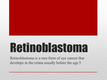 Retinoblastoma Retinoblastoma is a rare form of eye cancer that develops in the retina usually before the age 5.