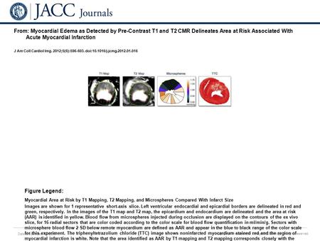 Date of download: 7/3/2016 Copyright © The American College of Cardiology. All rights reserved. From: Myocardial Edema as Detected by Pre-Contrast T1 and.