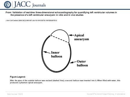 Date of download: 7/5/2016 Copyright © The American College of Cardiology. All rights reserved. From: Validation of real-time three-dimensional echocardiography.