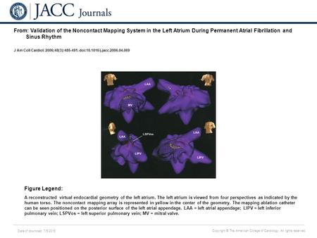 Date of download: 7/5/2016 Copyright © The American College of Cardiology. All rights reserved. From: Validation of the Noncontact Mapping System in the.