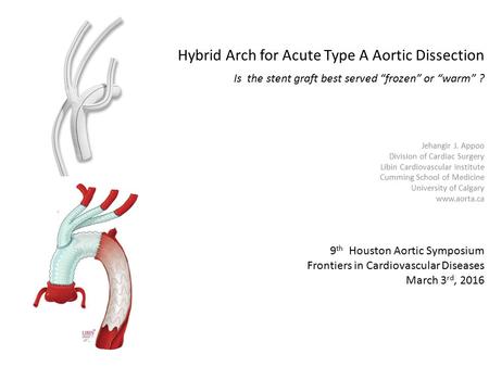 Hybrid Arch for Acute Type A Aortic Dissection