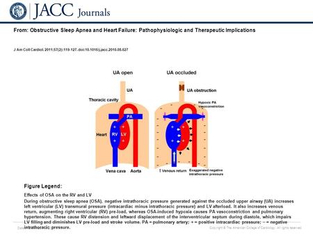 Date of download: 7/6/2016 Copyright © The American College of Cardiology. All rights reserved. From: Obstructive Sleep Apnea and Heart Failure: Pathophysiologic.