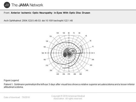 Date of download: 7/6/2016 Copyright © 2016 American Medical Association. All rights reserved. From: Anterior Ischemic Optic Neuropathy in Eyes With Optic.