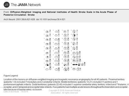 Date of download: 7/6/2016 Copyright © 2016 American Medical Association. All rights reserved. From: Diffusion-Weighted Imaging and National Institutes.