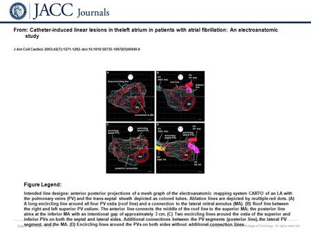 Date of download: 7/6/2016 Copyright © The American College of Cardiology. All rights reserved. From: Catheter-induced linear lesions in theleft atrium.