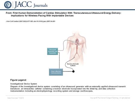 Date of download: 7/6/2016 Copyright © The American College of Cardiology. All rights reserved. From: First Human Demonstration of Cardiac Stimulation.