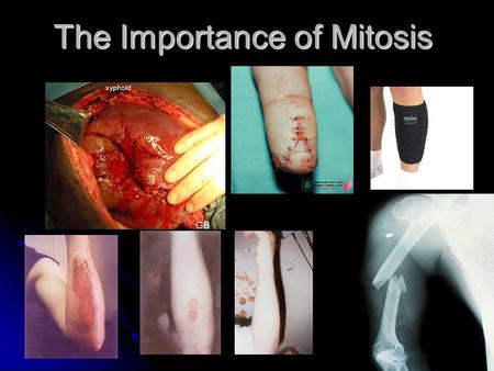 The Importance of Mitosis. The need to heal! The need to grow!