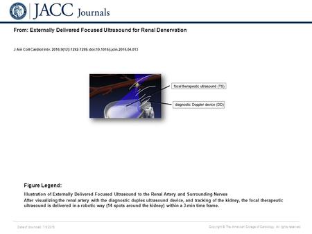 Date of download: 7/6/2016 Copyright © The American College of Cardiology. All rights reserved. From: Externally Delivered Focused Ultrasound for Renal.