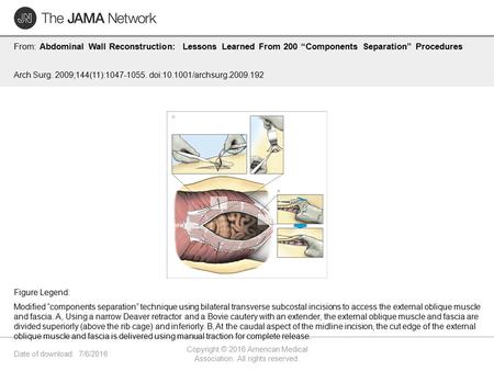 Date of download: 7/6/2016 Copyright © 2016 American Medical Association. All rights reserved. From: Abdominal Wall Reconstruction: Lessons Learned From.