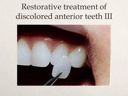 Restorative treatment of discolored anterior teeth III