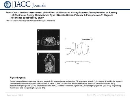 Date of download: 7/6/2016 Copyright © The American College of Cardiology. All rights reserved. From: Cross-Sectional Assessment of the Effect of Kidney.