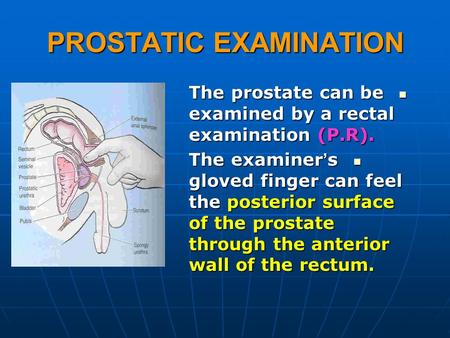 PROSTATIC EXAMINATION The prostate can be examined by a rectal examination (P.R). The prostate can be examined by a rectal examination (P.R). The examiner.