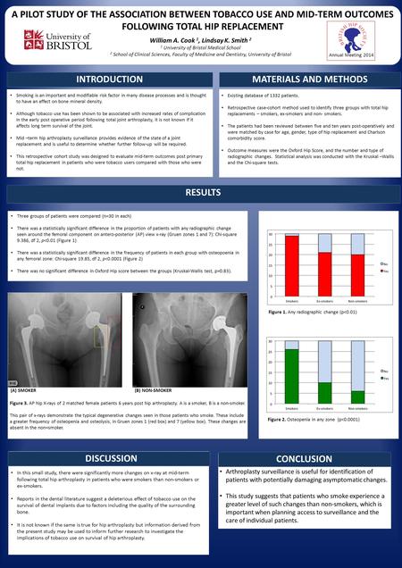 A PILOT STUDY OF THE ASSOCIATION BETWEEN TOBACCO USE AND MID-TERM OUTCOMES FOLLOWING TOTAL HIP REPLACEMENT William A. Cook 1, Lindsay K. Smith 2 1 University.