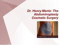 Dr. Henry Mentz: The Abdominoplasty Cosmetic Surgery