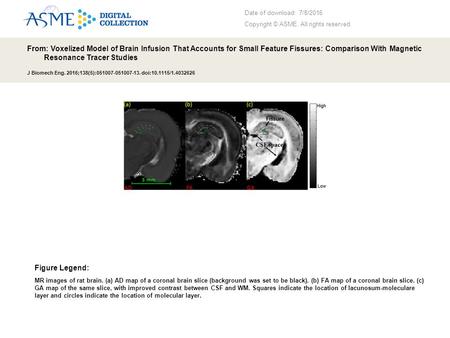 Date of download: 7/8/2016 Copyright © ASME. All rights reserved. From: Voxelized Model of Brain Infusion That Accounts for Small Feature Fissures: Comparison.