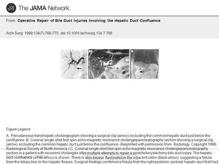 Date of download: 7/8/2016 Copyright © 2016 American Medical Association. All rights reserved. From: Operative Repair of Bile Duct Injuries Involving the.