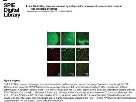 Date of download: 7/8/2016 Copyright © 2016 SPIE. All rights reserved. ChR2-EYFP expression in transgenic mouse brain slices. (a) Fluorescent microscope.