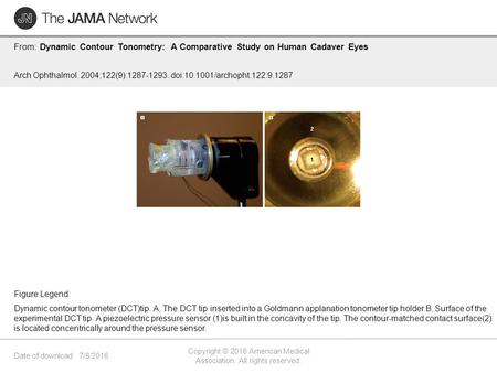 Date of download: 7/8/2016 Copyright © 2016 American Medical Association. All rights reserved. From: Dynamic Contour Tonometry: A Comparative Study on.