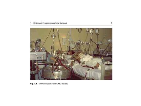 Systemic anticoagulation during ECMO is intended to control thrombin generation and limit the risk for thrombotic and hemorrhagic complications.