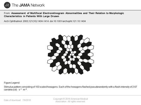 Date of download: 7/9/2016 Copyright © 2016 American Medical Association. All rights reserved. From: Assessment of Multifocal Electroretinogram Abnormalities.