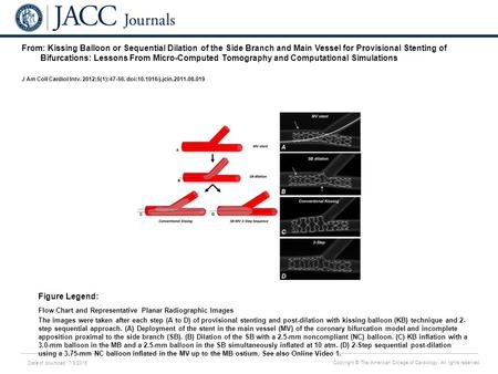 Date of download: 7/9/2016 Copyright © The American College of Cardiology. All rights reserved. From: Kissing Balloon or Sequential Dilation of the Side.