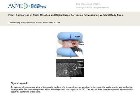 Date of download: 7/9/2016 Copyright © ASME. All rights reserved. From: Comparison of Strain Rosettes and Digital Image Correlation for Measuring Vertebral.