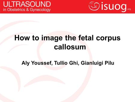 How to image the fetal corpus callosum