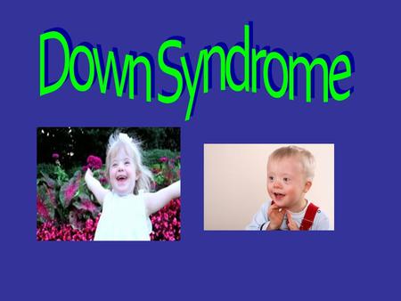 What it is. Down Syndrome is a congenital disorder in which the genetic material causes an abnormal development of children and often leads to mental.