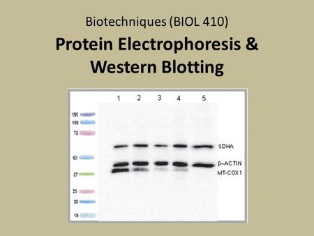 Protein Electrophoresis & Western Blotting