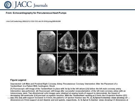 Date of download: 7/10/2016 Copyright © The American College of Cardiology. All rights reserved. From: Echocardiography for Percutaneous Heart Pumps J.