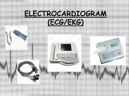 ELECTROCARDIOGRAM (ECG/EKG)