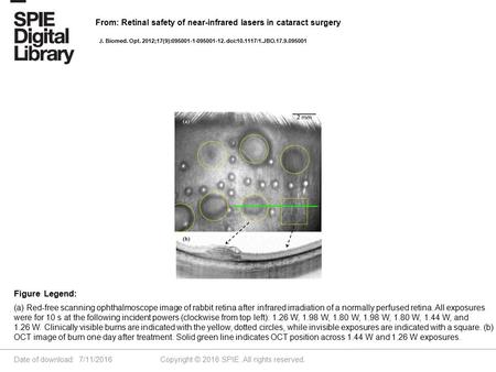 Date of download: 7/11/2016 Copyright © 2016 SPIE. All rights reserved. (a) Red-free scanning ophthalmoscope image of rabbit retina after infrared irradiation.