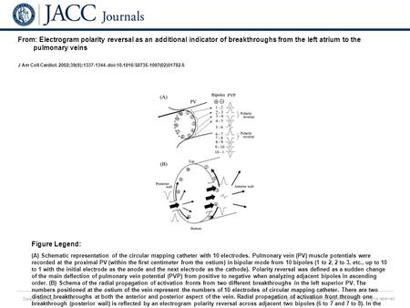 Date of download: 7/11/2016 Copyright © The American College of Cardiology. All rights reserved. From: Electrogram polarity reversal as an additional indicator.