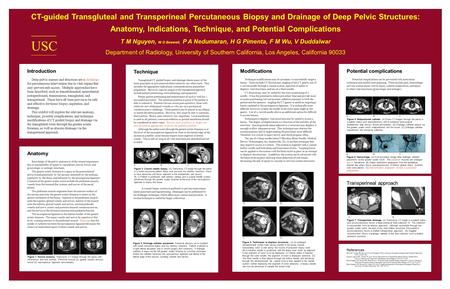 Introduction Deep pelvic masses and abscesses are a challenge for percutaneous intervention due to vital organs that may prevent safe access. Multiple.