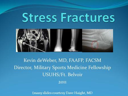 Stress Fractures Kevin deWeber, MD, FAAFP, FACSM